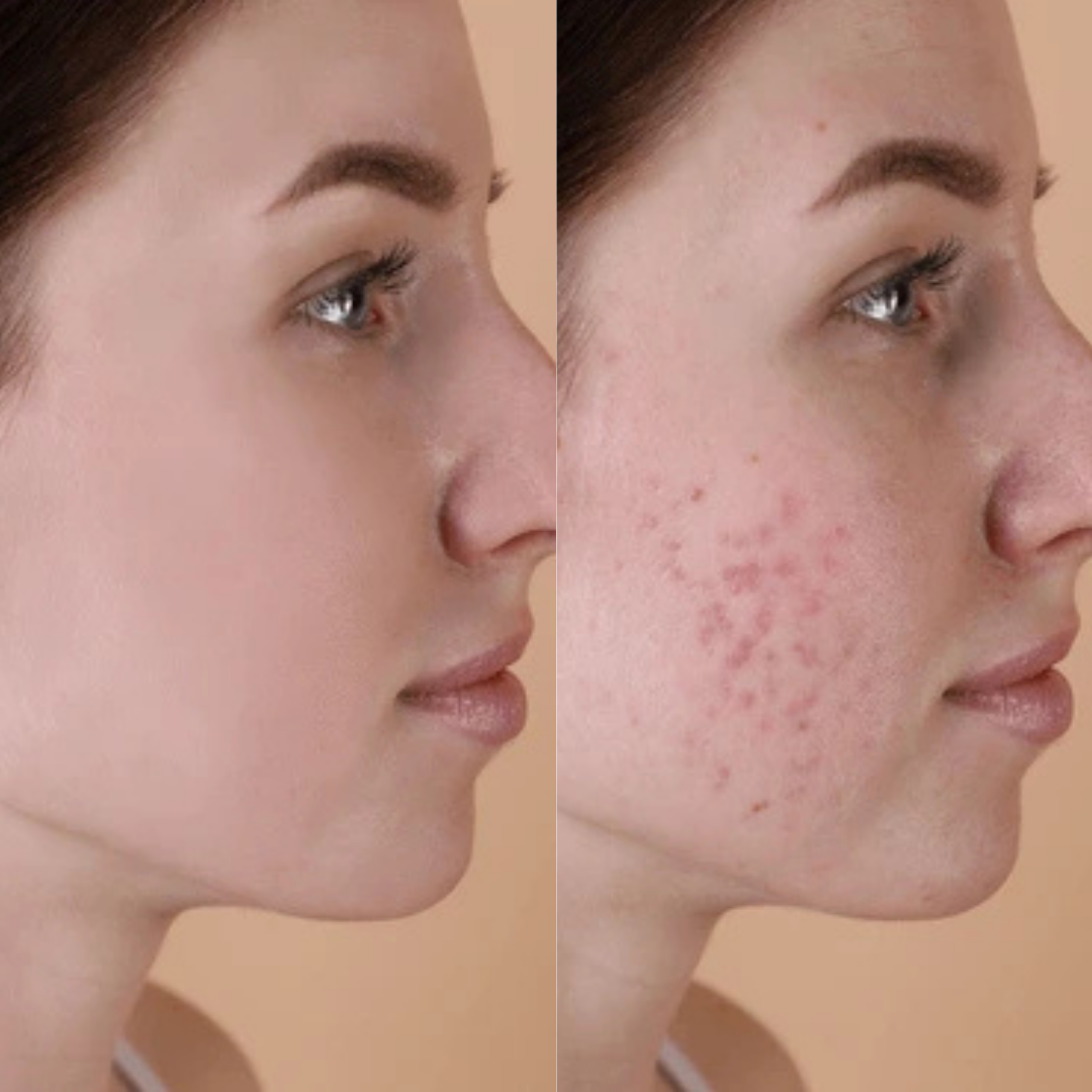 NAD+ Clear Skin Capsules